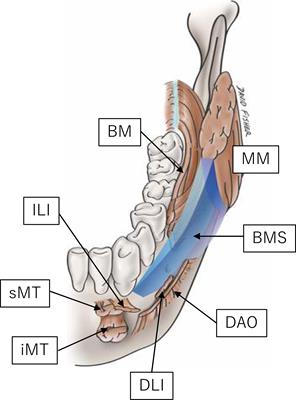 Invasion of the bucco-mandibular space by oral squamous cell carcinoma: histopathological analysis of invasion pattern